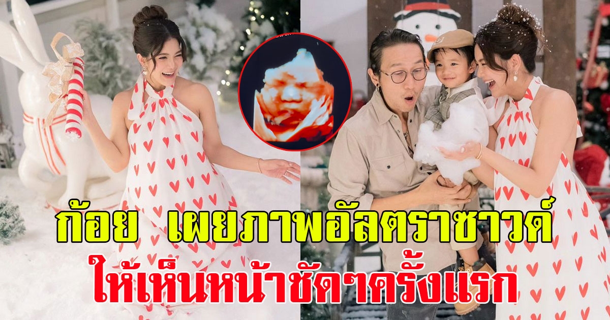 ก้อย รัชวิน โพสต์โมเมนต์ซึ้ง เผยภาพอัลตราซาวด์ลูก ให้เห็นหน้าชัดๆครั้งแรก