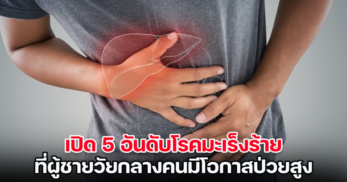 ระวังให้ดี! เปิด 5 อันดับโรคมะเร็งร้าย ที่ผู้ชายวัยกลางคนมีโอกาสป่วยสูง