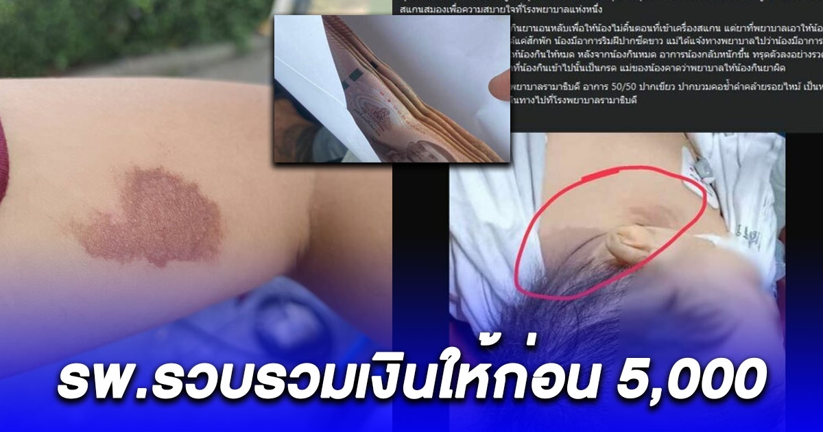 รพ.รวบรวมเงินให้ 5,000 หลังจ่ายยาพลาดให้เด็ก 1 ขวบ