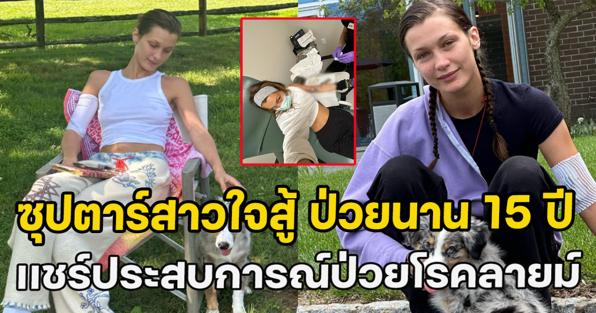 ซุปตาร์สาวใจสู้ ป่วยนาน 15 ปี เเชร์ประสบการณ์ป่วยโรคลายม์