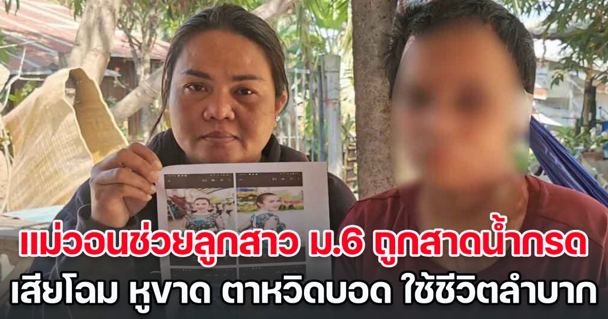 ชีวิตพังทลาย! แม่วอนช่วยลูกสาว ม.6 ถูกสาดน้ำกรดเสียโฉม หูขาด ตาหวิดบอด กลัวลูกไม่อยากมีชีวิตอยู่