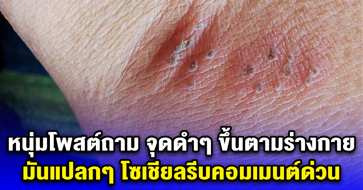 หนุ่มโพสต์ถาม จุดดำๆ ขึ้นตามร่างกาย มันแปลกๆ โซเชียลรีบคอมเมนต์ด่วน