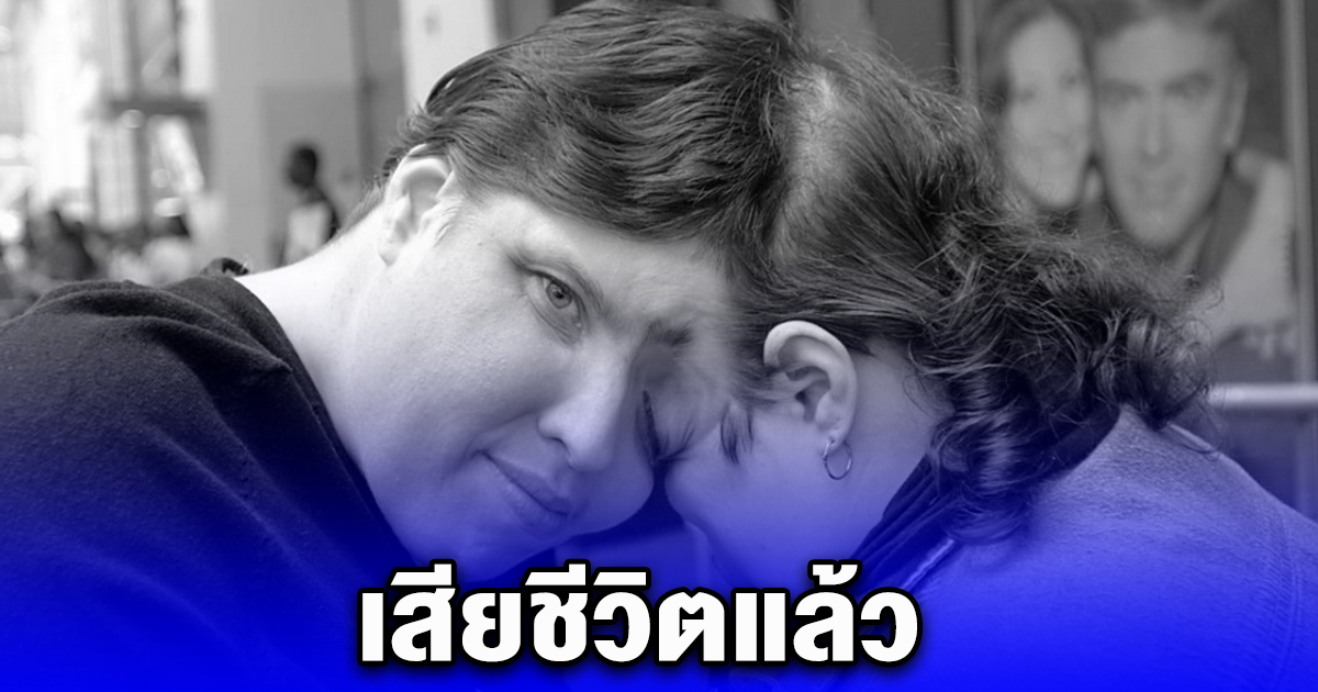 แฝดศีรษะติดกัน ลอรี-จอร์จ แชปเพลล์ เสียชีวิตแล้วในวัย 62 ปี