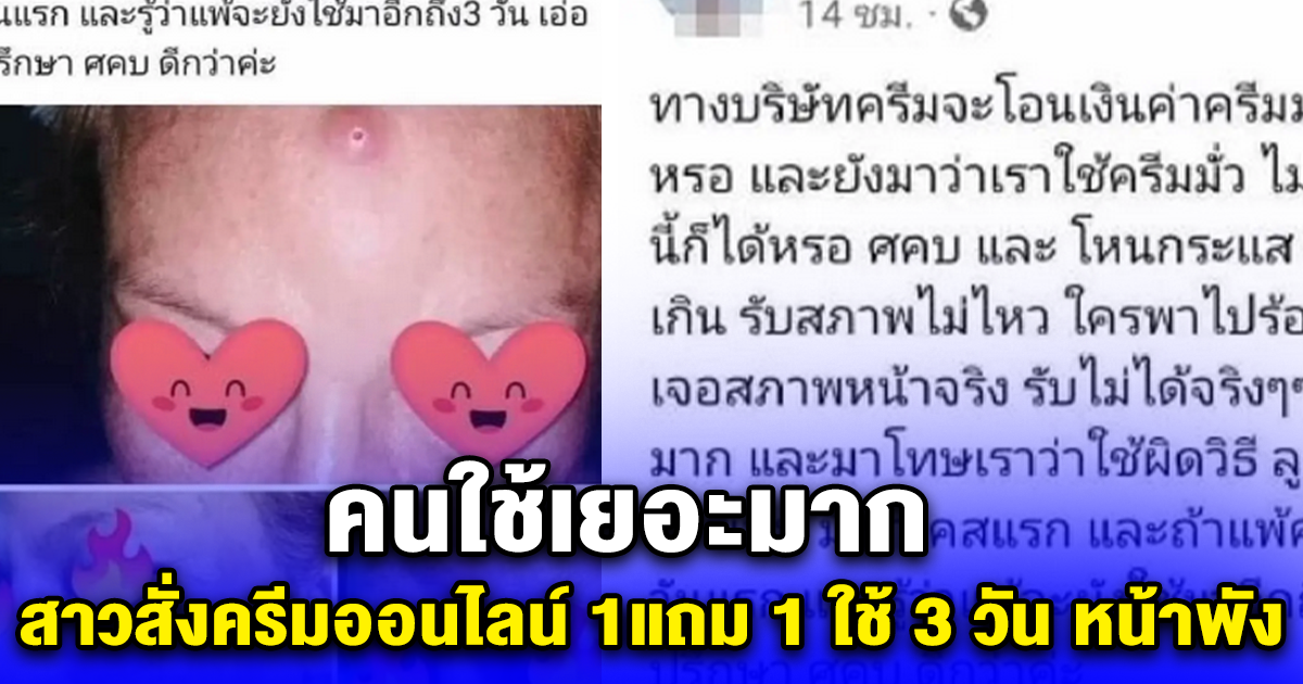 คนใช้เยอะมาก สาวสั่งครีมออนไลน์ 1แถม 1 ใช้ 3 วัน หน้าพัง
