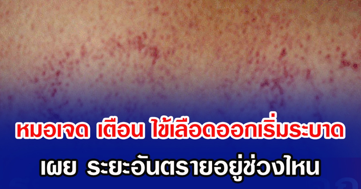 หมอเจดโพสต์เตือน ไข้เลือดออกเริ่มระบาดอีกระลอก เผย ระยะอันตรายอยู่อยู่ช่วงไหน