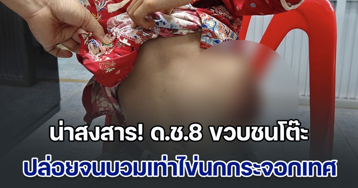น่าสงสาร! ด.ช.8 ขวบชนโต๊ะ ไม่กล้าบอกครู กลัวไปหาหมอ แล้วทางบ้านไม่มีเงินจ่าย ปล่อยจนบวมเท่าไข่นกกระจอกเทศ