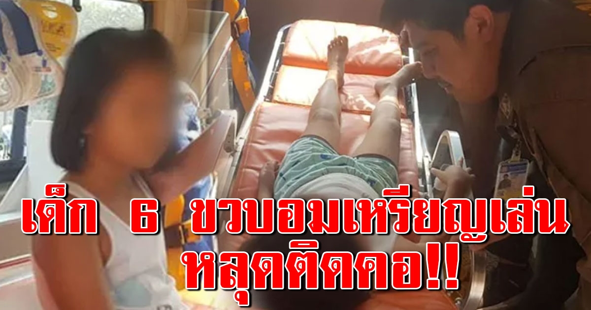 เด็กหญิงวัย 6 ขวบ อมเหรียญบาทเล่น เผลอกลืนเหรียญ หลุดติดคอ