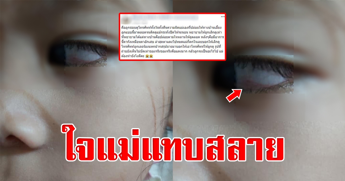 แม่ปล่อยให้ลูกสาวเล่นโทรศัพท์เป็นเวลา สุดท้ายช็อคหนัก เมื่อมองไปเห็นดวงตาลูก