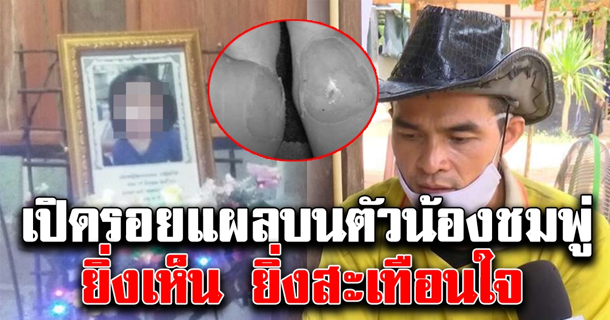 ลุง เปิดรอยแผลบนตัว น้องชมพู่ พบที่ฝ่าเท้า เห็นแต่ละจุด น้องคงทรมานมาก