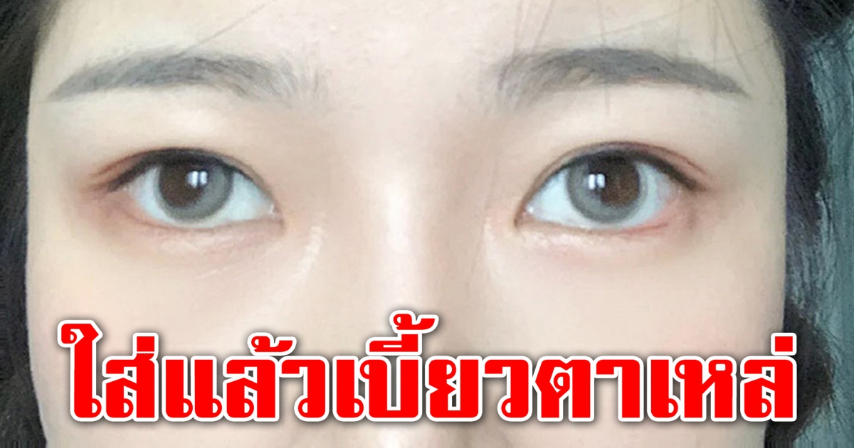 สาวโวย สั่งคอนแทคเลนส์ แต่ได้ไม่ตรงปก