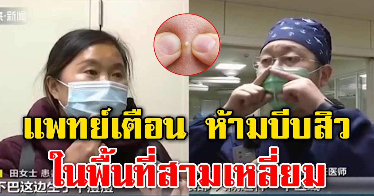 บีบสิวเป็นเหตุ บีบสิวในพื้นที่สามเหลี่ยม