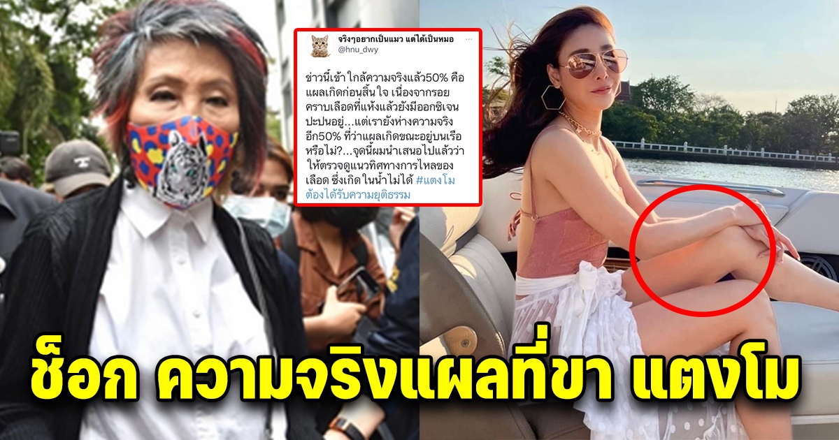 หมอวิเคราะห์แผลที่ขาของ แตงโม เกิดบนบกในท่ายืนหรือนั่งชันเข่า