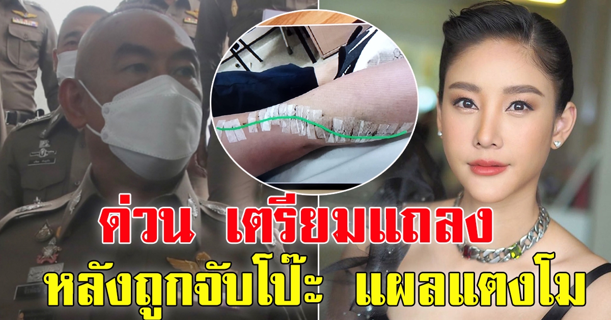ด่วน ตำรวจ เตรียมแถลง วันนี้ หลัง ถูกชาวเน็ต ตั้งข้อสังเกต แผลแตงโม ไม่ได้เกิดจากใบพัด