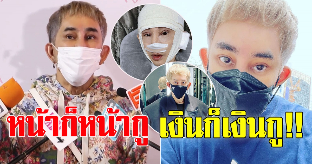 พจน์ อานนท์ ทำหน้าใหม่