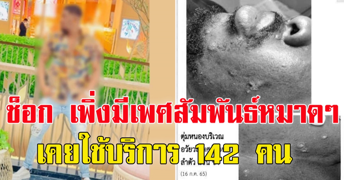 ภูเก็ตแถลง ปมชาวไนจีเรียป่วยฝีดาษลิงหนี เร่งล่าตัวขู่ใช้กฎหมายสูงสุด