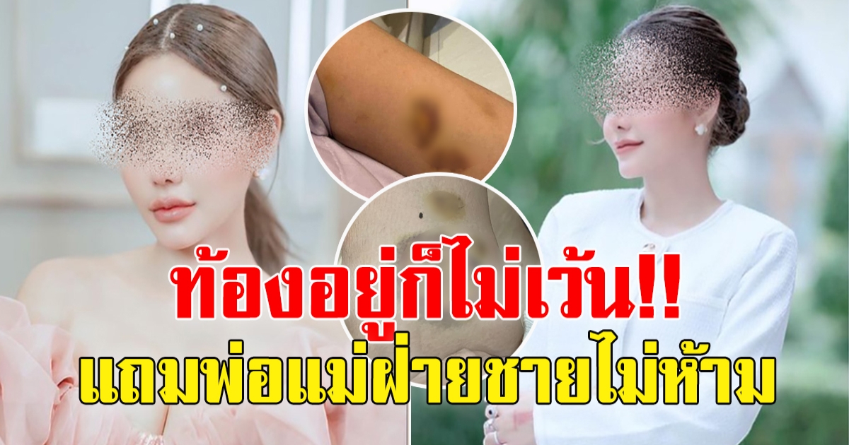 ไฮโซสาวโดนอดีตสามี ลูกชายดีเจดังทำร้าย ท้องยังไม่เว้น พ่อ-แม่ฝ่ายชายก็อยู่ แต่ไม่ห้าม