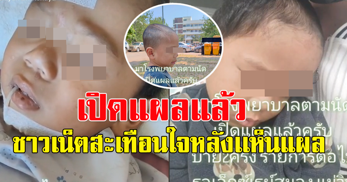 จำได้ไหม น้องสุมาอี้ หนูน้อย ศูนย์เด็กเล็กหนองบัวลำภู