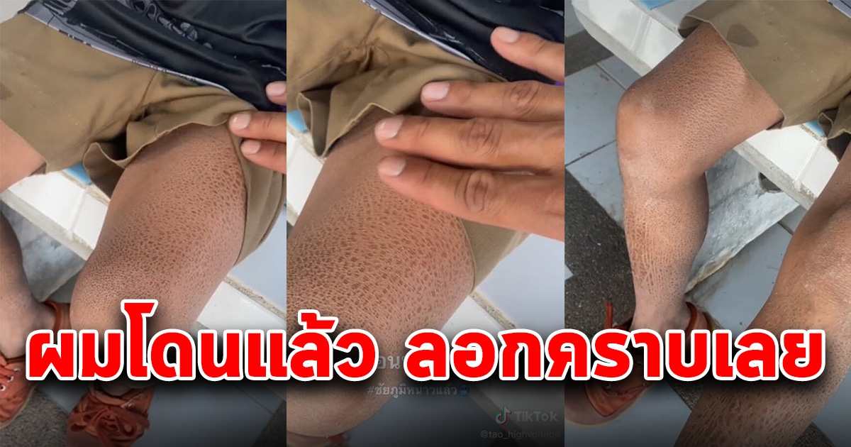 นักเรียนชายเจอลมหนาว เห็นขาแล้วตกใจ จนเพื่อนๆต้องแซว