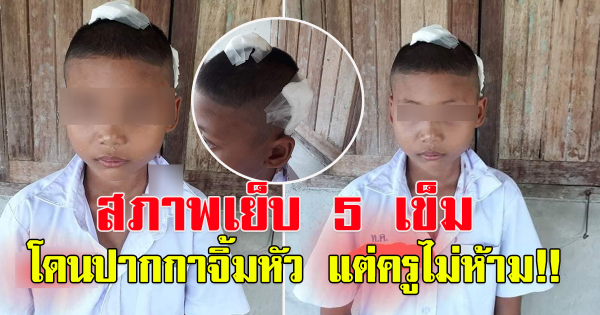 พ่อโพสต์ ลูกชายไปโรงเรียน ยังไม่ถึงครึ่งวัน ครูพามาส่ง