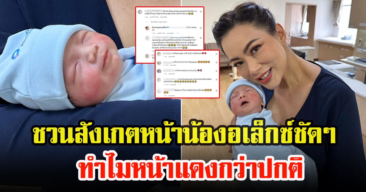 บุ๋ม ปนัดดา ชวนสังเกตหน้าน้องอเล็กซ์ พร้อมตั้งข้อสงสัย หลังลูกชายหน้าแดงผิดปกติ