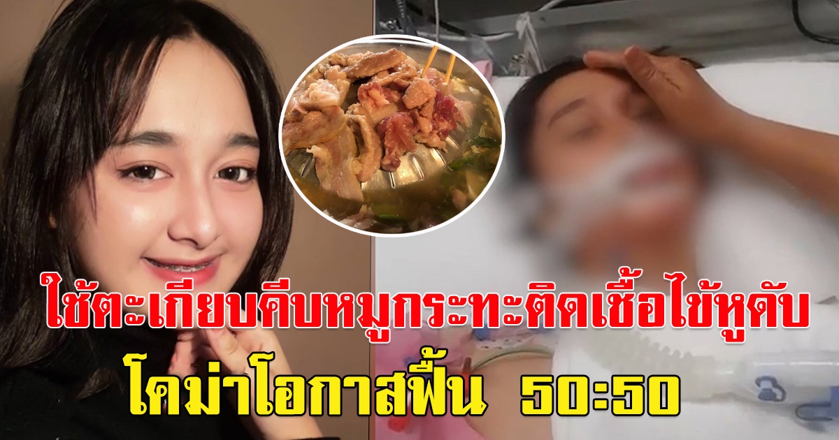 อุทาหรณ์ คนชอบกินหมูกระทะ ใช้ตะเกียบคีบหมูกระทะทำติดโรคไข้หูดับ สาววัย 17 โคม่าโอกาสฟื้น 50:50