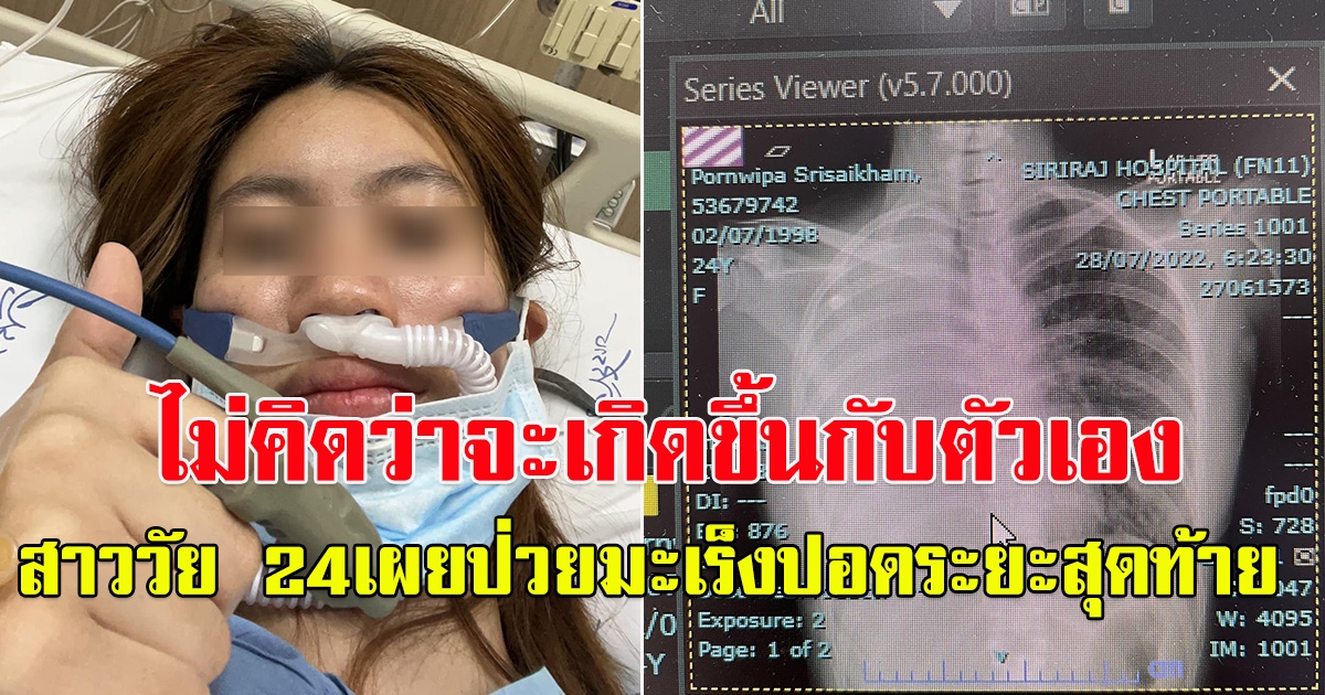 สาววัย 24 แชร์ประสบการณ์ป่วย มะเร็งปอดระยะสุดท้าย ไม่คิดจะเกิดขึ้นกับตัวเอง