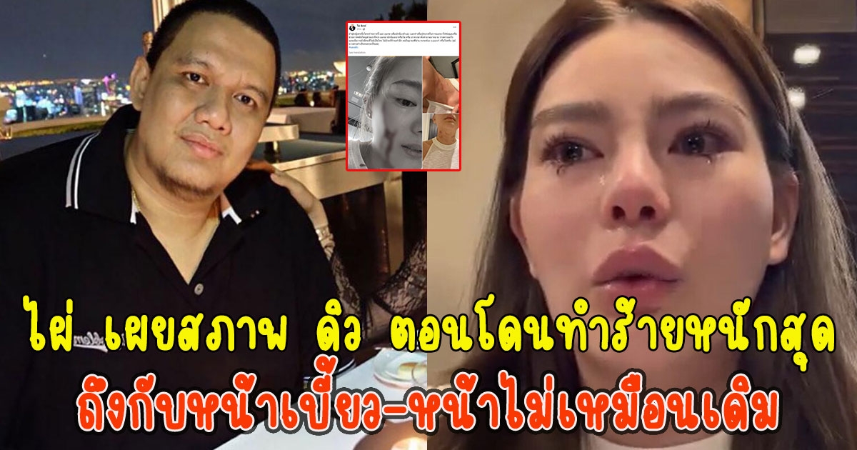 ไผ่ เผยสภาพ ดิว ตอนโดนทำร้ายหนักสุด ถึงกับหน้าเบี้ยว-หน้าไม่เหมือนเดิม