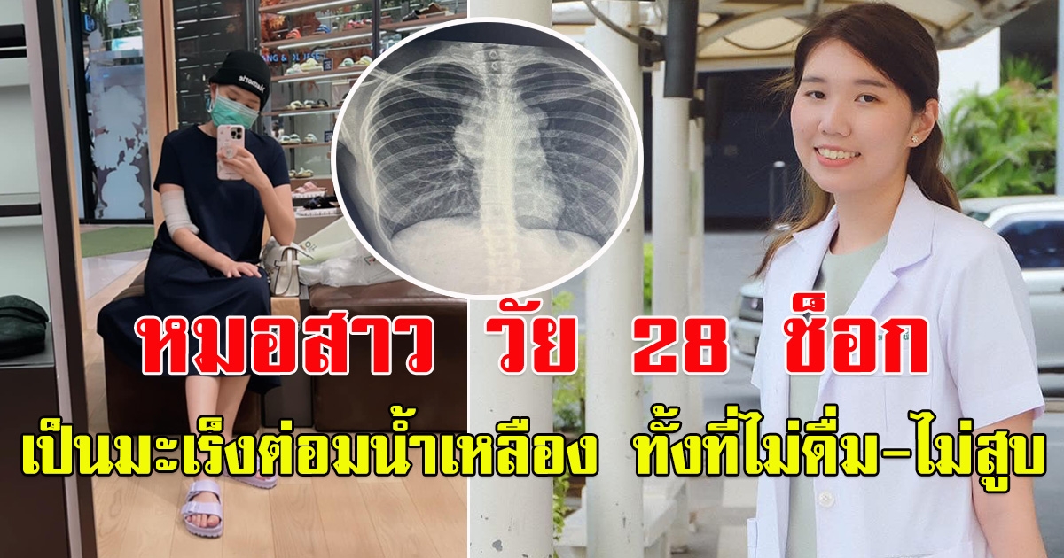 หมอสาว วัย 28 ปี เป็นมะเร็งต่อมน้ำเหลือง ทั้งที่ไม่ดื่ม-ไม่สูบ
