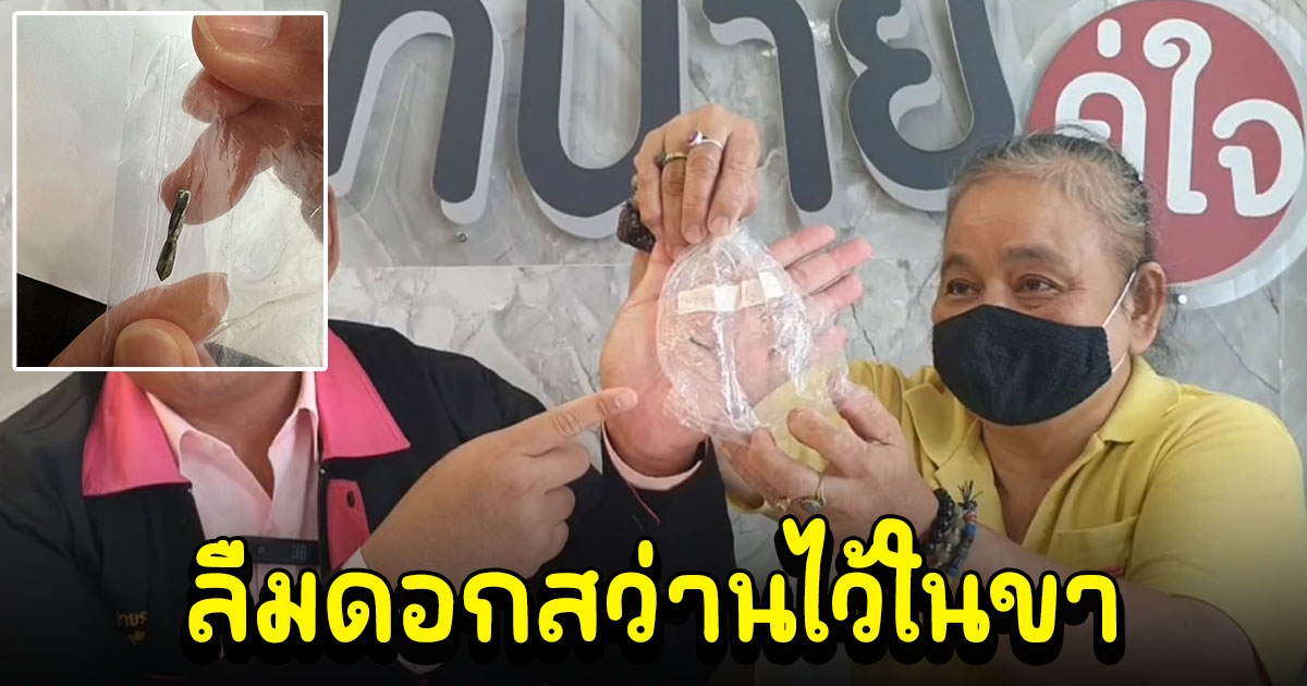 ผงะ ป้าวัย 57 ปี ร้องทนายดัง รพ.ชุ่ยลืมดอกสว่านไว้ในขา ไร้เยียวยา