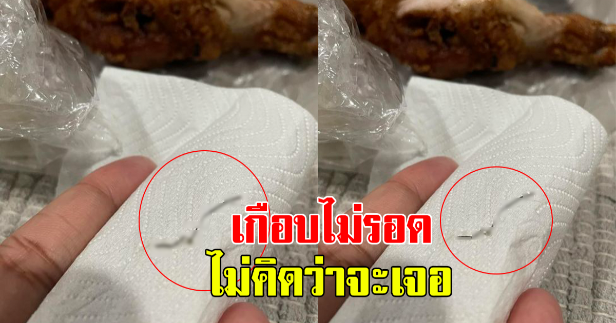 หนุ่มกินไก่ ติดคอ คิดว่ากระดูก พอออกมาได้กลับไม่ใช่