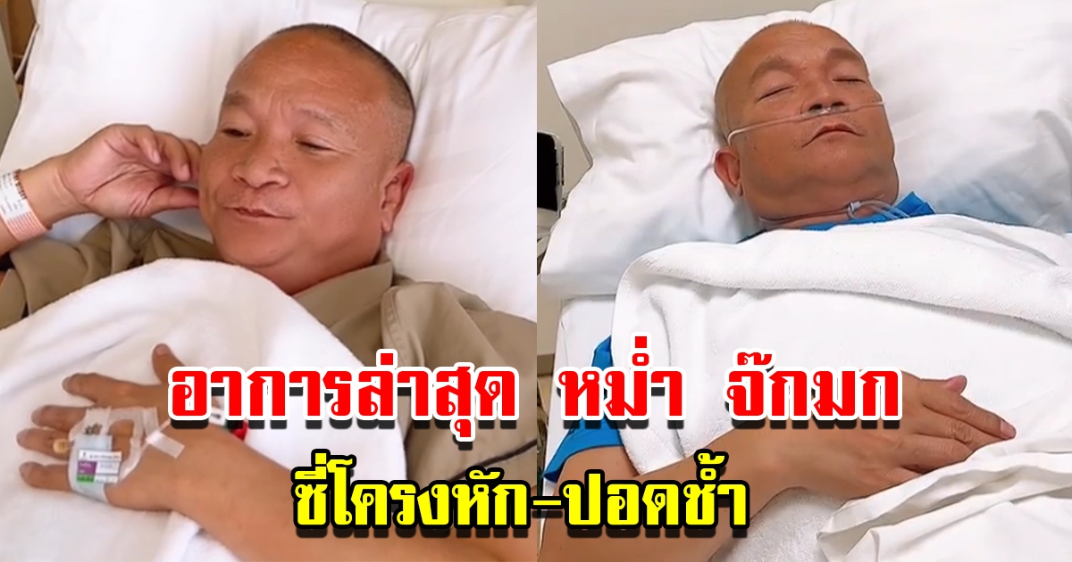 เผยอาการล่าสุด หม่ำ จ๊กมก ซี่โครงหัก-ปอดช้ำ ลั่นหักทุกอย่าง