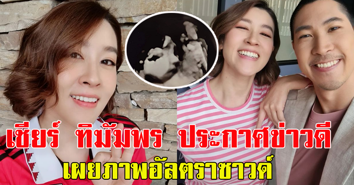 เชียร์ ฑิฆัมพร ประกาศข่าวดี เผยภาพอัลตราซาวด์