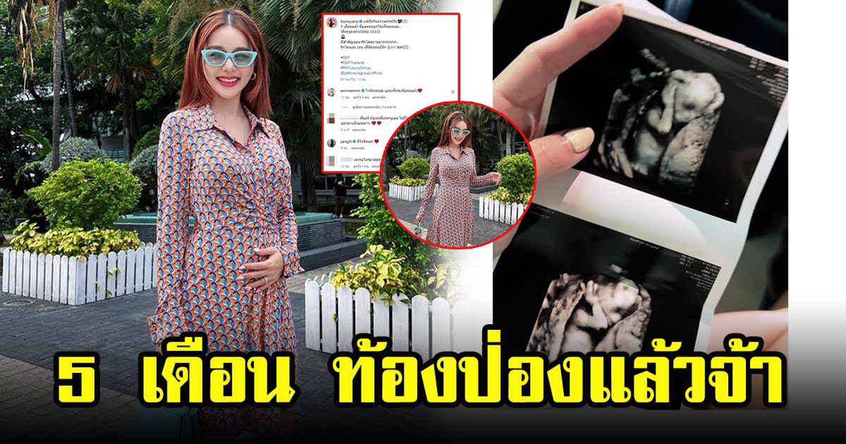 แอร์ ภัณฑิลา ประกาศตั้งท้องลูกคนแรก 5 เดือนแล้ว ภาพล่าสุดท้องป่องเห็นชัดเจน