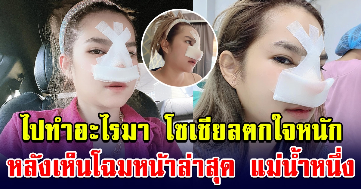 ไปทำไรมาเนี่ย โซเชียลแห่ตกใจ หลังเห็นโฉมหน้าล่าสุดแม่น้ำหนึ่ง
