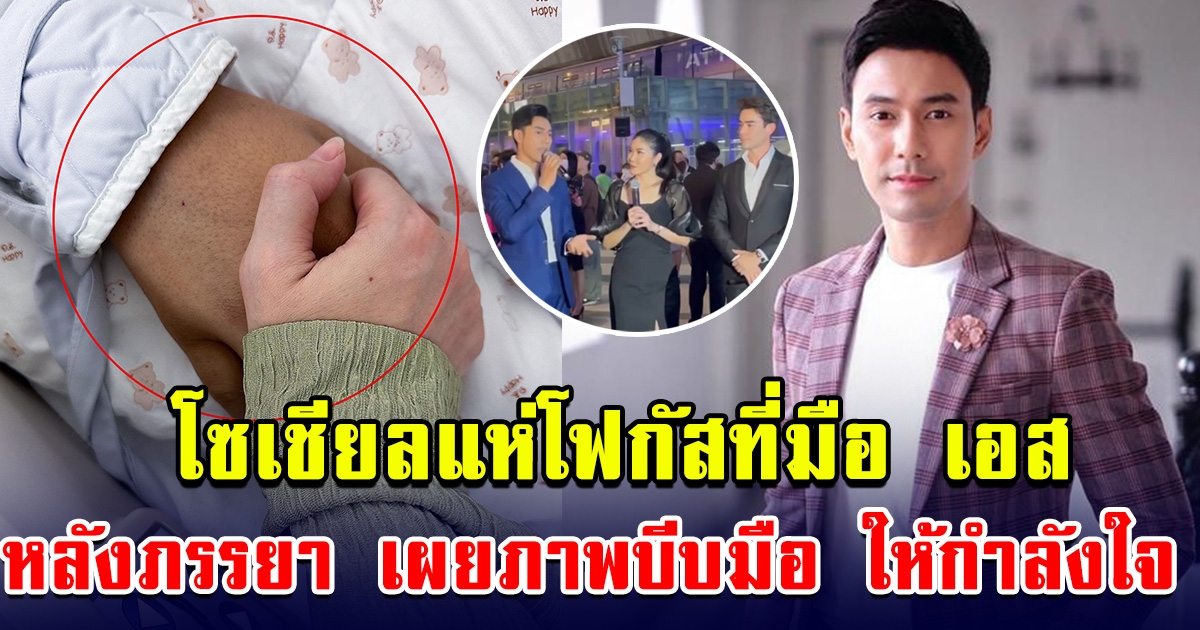 โซเชียลแห่โฟกัสที่มือ เอส กันตพงศ์ หลังยังต้องรักษาตัวที่ รพ.