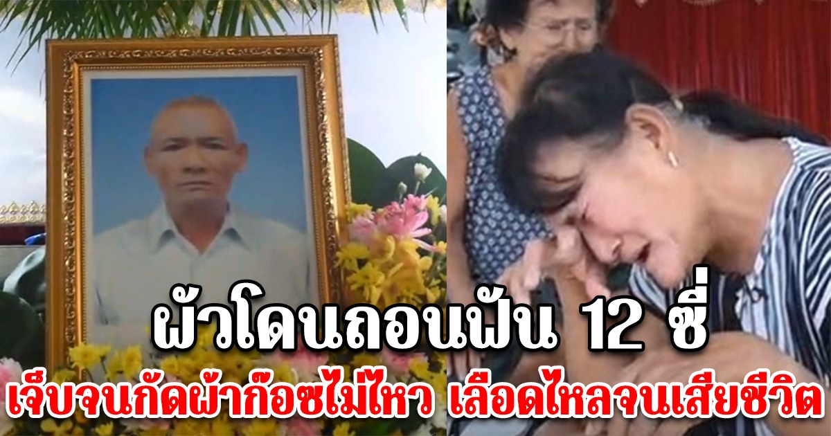 ผัวถูกหมอถอนฟัน 12 ซี่ ขณะนอนรักษาตัวใน รพ. ไม่มีแรงกัดผ้าก๊อซ เลือดไหล จนเสียชีวิต