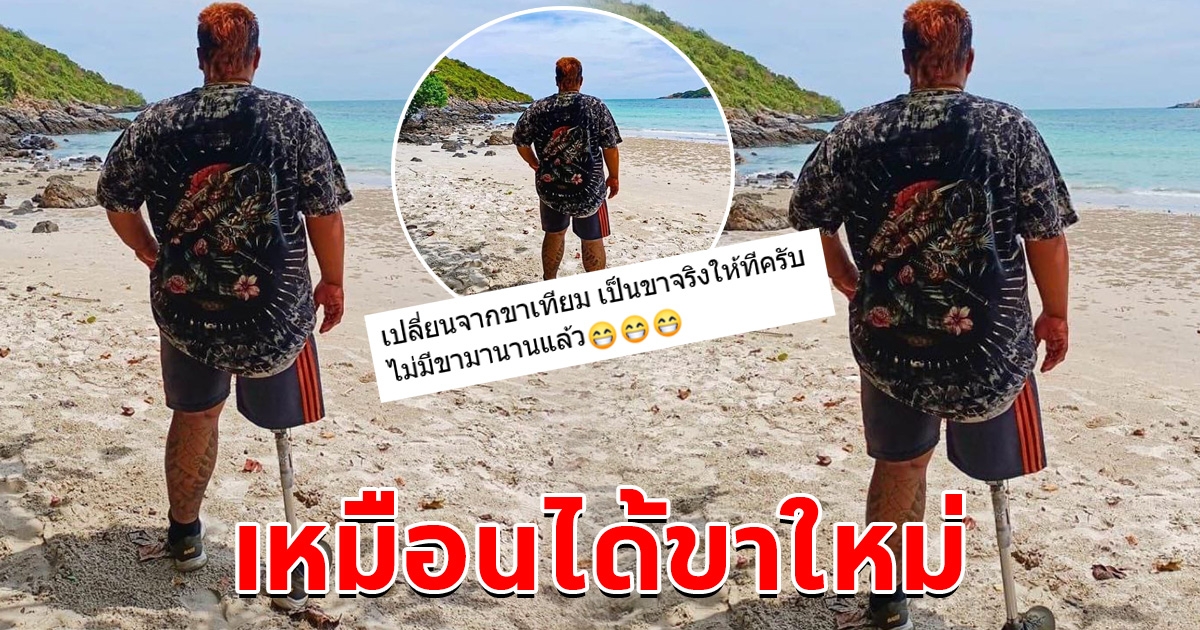 อบอุ่นหัวใจ หนุ่มบอกไม่มีขามานาน โซเชียลส่งกำลังใจช่วยแต่งรูปเปลี่ยนขาให้