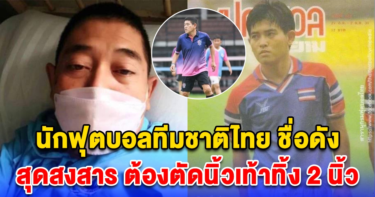 สาธิต จึงสำราญ อดีตนักฟุตบอลทีมชาติไทย สุดสงสาร ต้องตัดนิ้วเท้าทิ้ง 2 นิ้ว