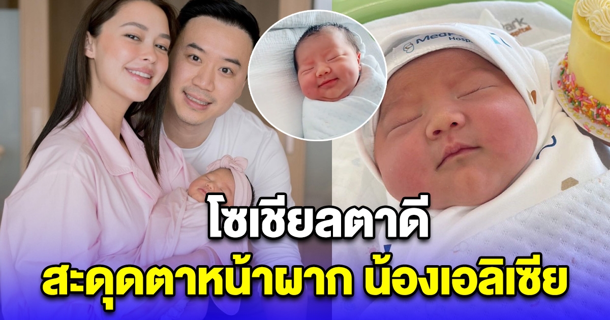 โซเชียลตาดี สะดุดตาหน้าผาก น้องเอลิเซีย