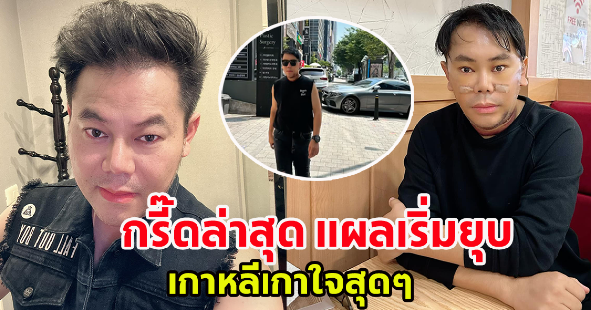 เพชร สหรัตน์ เผยภาพล่าสุด หลังบินไป เสริมหล่อที่เกาหลี ยุบแล้ว บอกเลยเกาหลีเกาใจสุดๆ