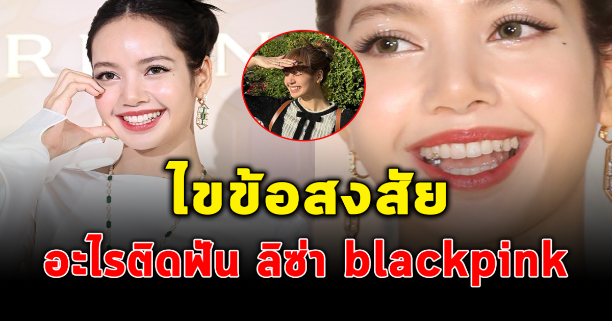 เฉลยแล้ว หลังหลายคนสงสัย มีอะไรติดฟัน ลิซ่า BLACKPINK