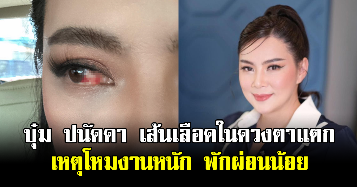 บุ๋ม ปนัดดา เส้นเลือดในดวงตาแตก เหตุโหมงานหนัก พักผ่อนน้อย