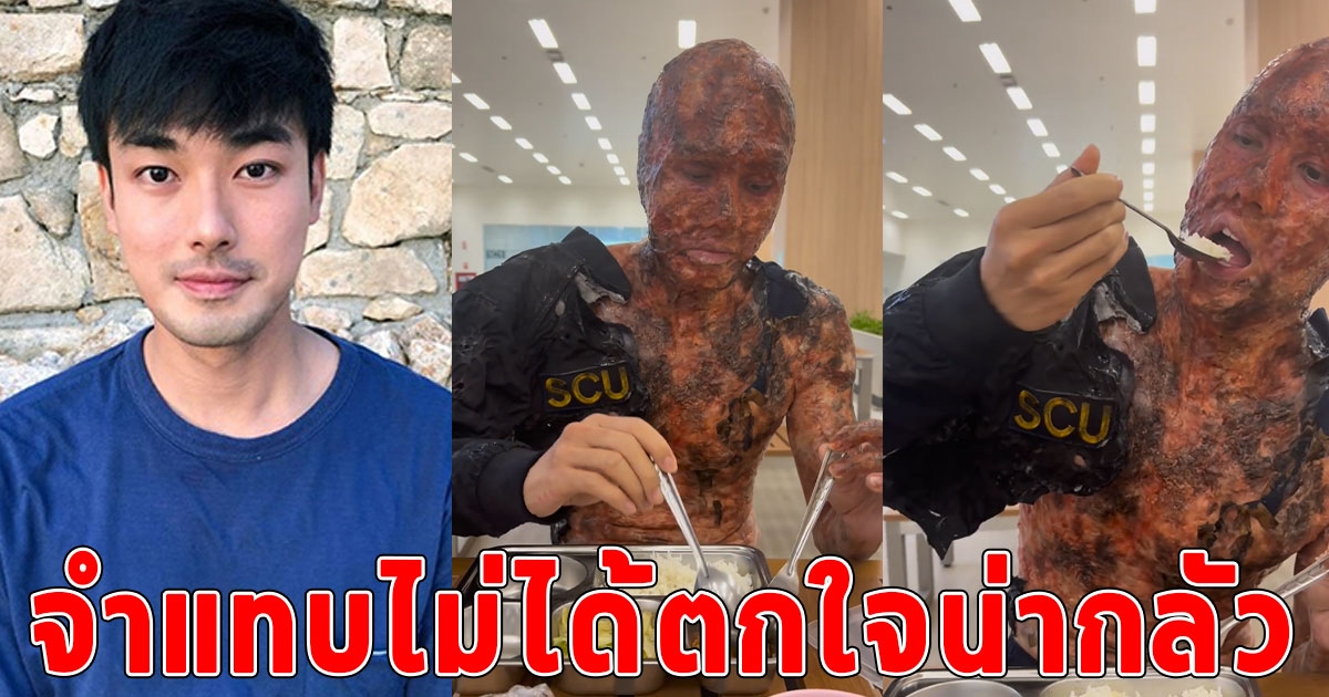 ตกใจทั้งโซเชียล แห่ถามไปทำอะไรมาเปิดภาพ หน่อง ธนา น้องชาย บอย เหมือนตัวไหม้เกรียม จำแทบไม่ได้