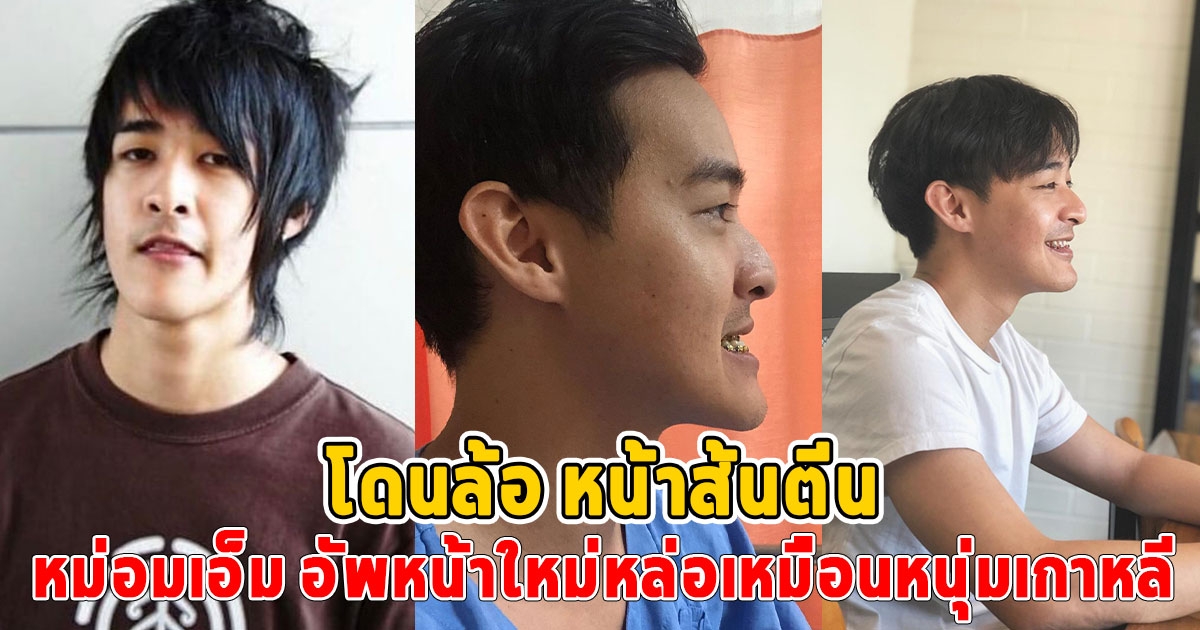 ส่องภาพล่าสุด หม่อมเอ็ม หลังทำหล่อ โดนล้อมาทั้งชีวิต