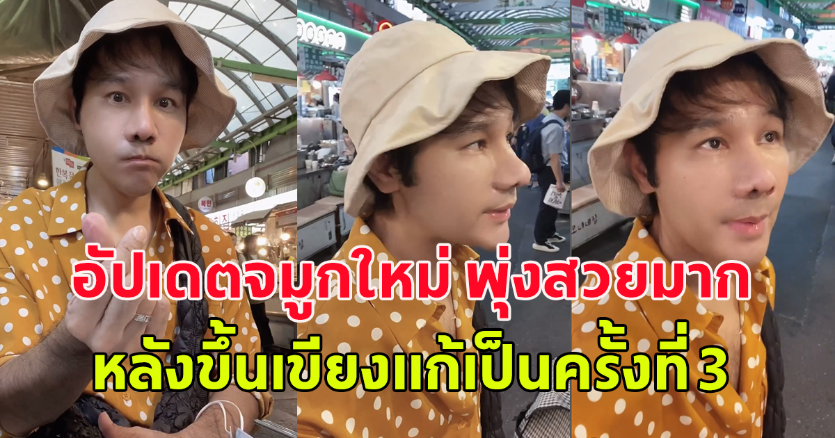 แววโอปป้าเริ่มมาแล้ว กอล์ฟ เบญจพล อัปเดตจมูกใหม่ พุ่งสวยมาก หลังขึ้นเขียงแก้เป็นครั้งที่ 3