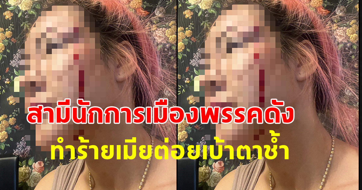 สามีนักการเมืองพรรคดัง ทำร้ายเมีย ต่อยเบ้าตาช้ำ ซ้ำโอนย้ายสินสมรสพันล้านหนี