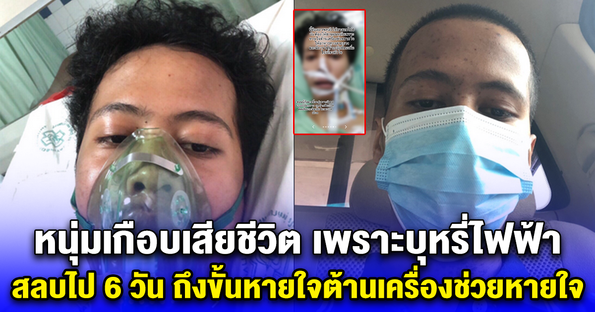 หนุ่มเกือบเสียชีวิต เพราะบุหรี่ไฟฟ้า สลบไป 6 วัน ถึงขั้นหายใจต้านเครื่องช่วยหายใจ