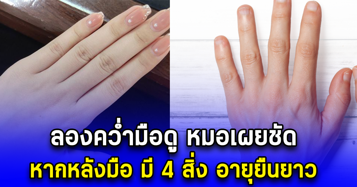 ลองคว่ำมือดู หมอเผยชัด หากหลังมือ มี 4 สิ่ง อายุยืนยาว