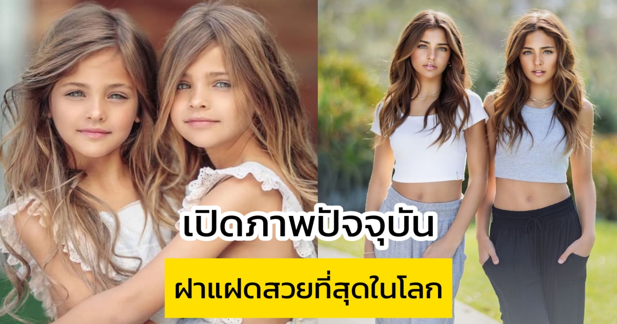 เปิดภาพปัจจุบัน ฝาแฝดสวยที่สุดในโลก เมื่อ 7 ปีก่อน ตอนนี้อายุ 14 ปีแล้ว