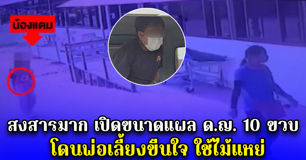 สงสารมาก เปิดขนาดแผล ด.ญ. 10 ขวบ โดนพ่อเลี้ยงขืนใจ ใช้ไม้แหย่